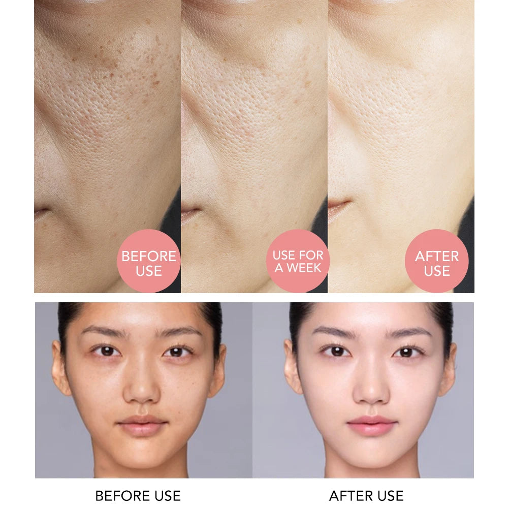 AILKE Whitening Serum, Anti-Aging, Reduce Freckles ,Dark Spots, With Rose Oil, Geranium Essential Oil, For Face & Body Essence