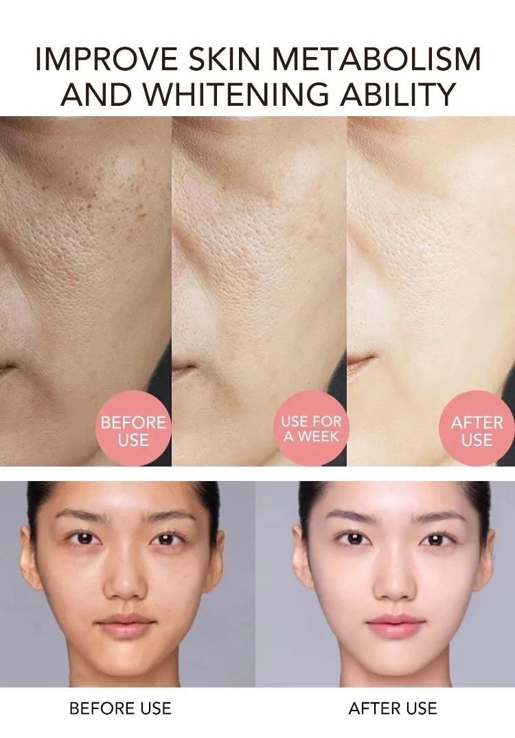 AILKE Whitening Serum, Anti-Aging, Reduce Freckles ,Dark Spots, With Rose Oil, Geranium Essential Oil, For Face & Body Essence