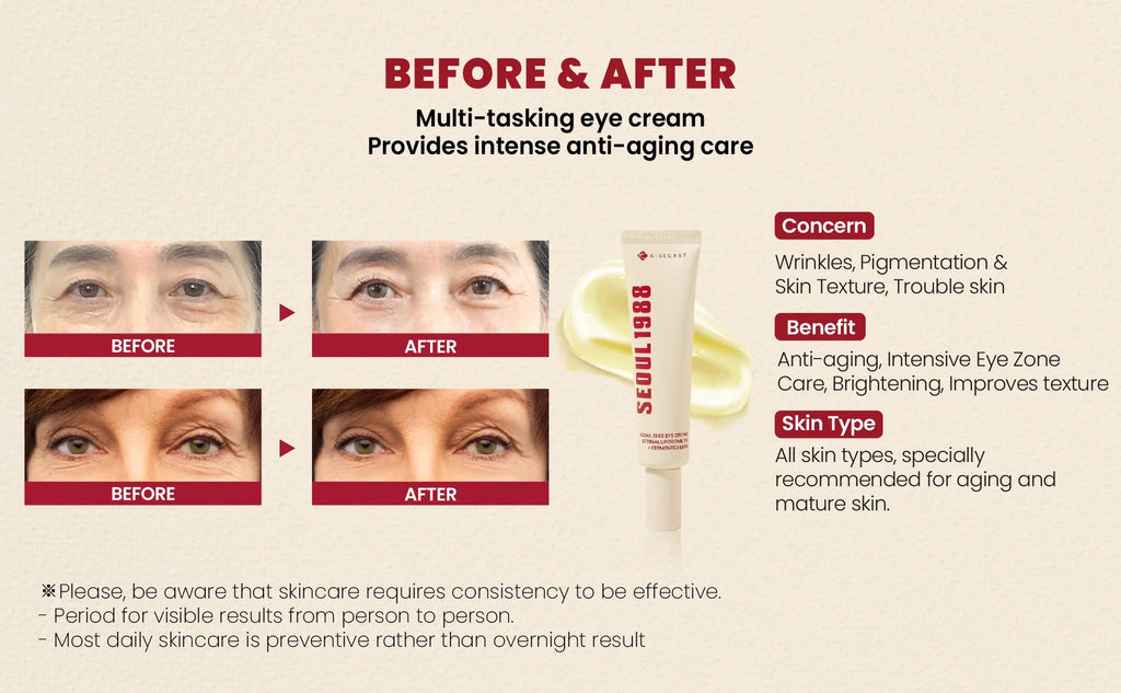 KSECRET SEOUL 1988 Retinal Liposome 4% Eye Cream with Fermented Bean, 30ml – Anti-Aging & Brightening