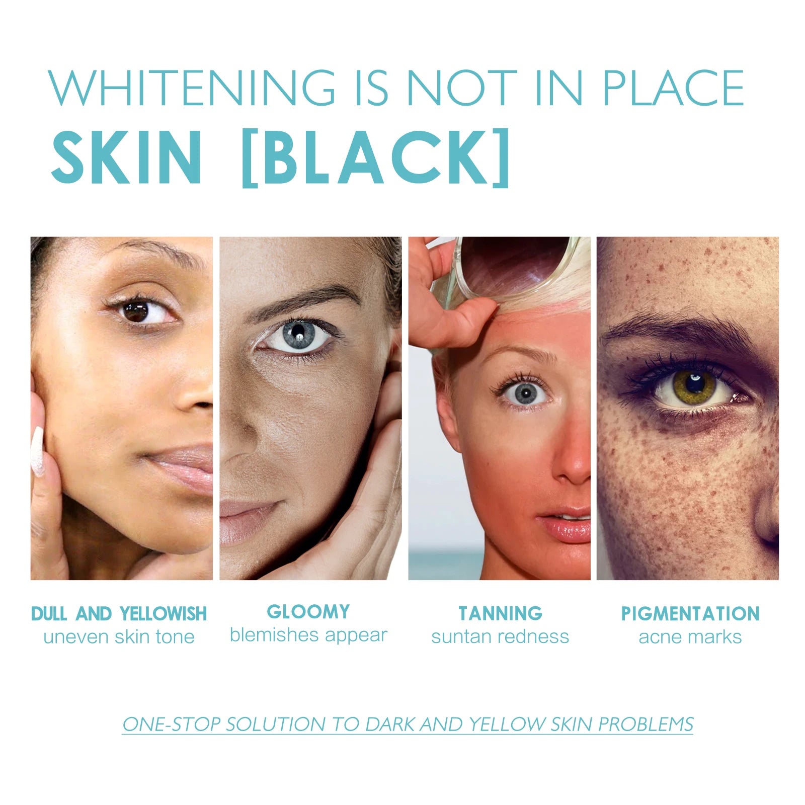 EELHOE Face Whitening Serum Remove Melasma Essence Fade Dark Spots Melanin Brightening Skin Essence Pigment Correction Products