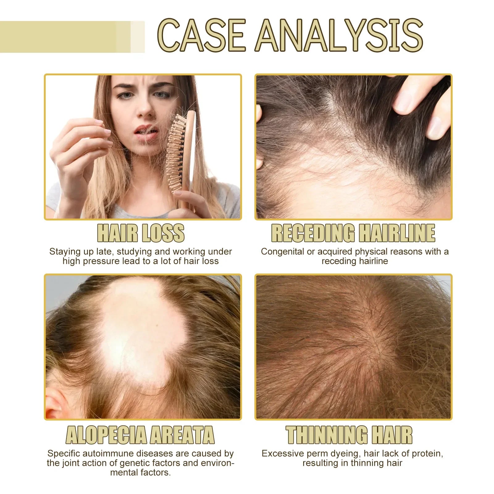 Treating Hair Loss Serum Anti Baldness Nourish Relieve Hair Dryness Regrowth Damage Repair Moisturizing Hair Growth Essence Oil