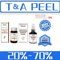 30ml Glycolic Acid Chemical Peel 70%/20% Peeling Acid skin remove skin Superforce Peeling Skin care