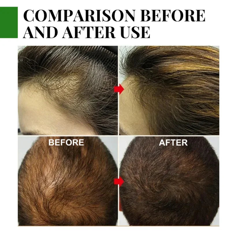 Rosemary Essential Oil Hair Growth Oils Pure Natural 30ML Hair Essential Oils For Nourish Shiny Hair Healthy